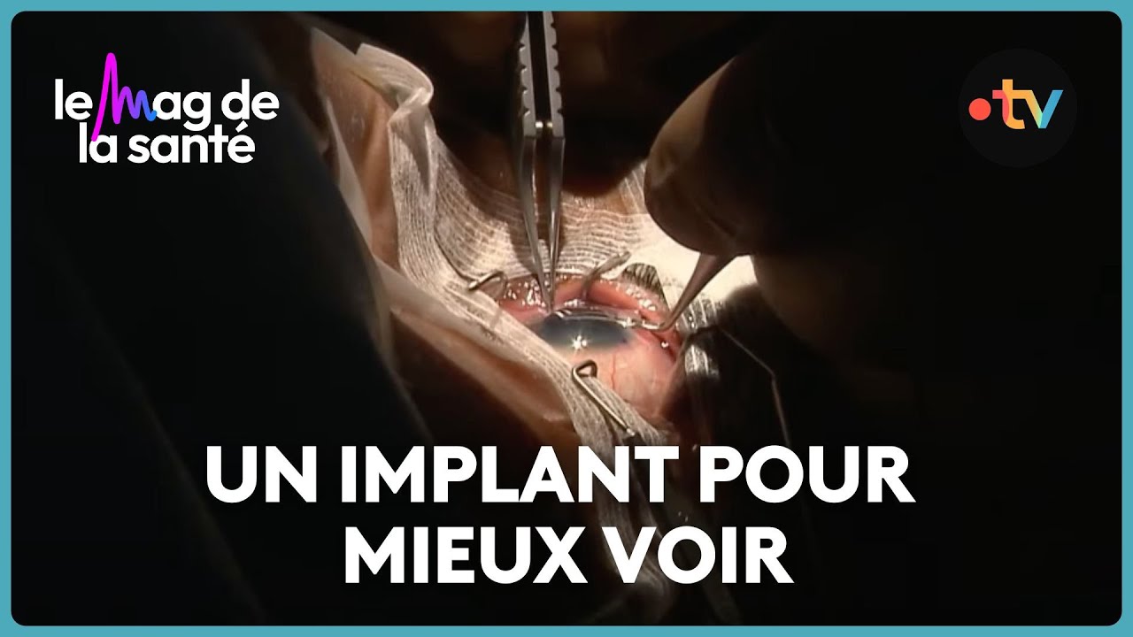 Comment se d&eacute;roule l'op&eacute;ration de la cataracte ?