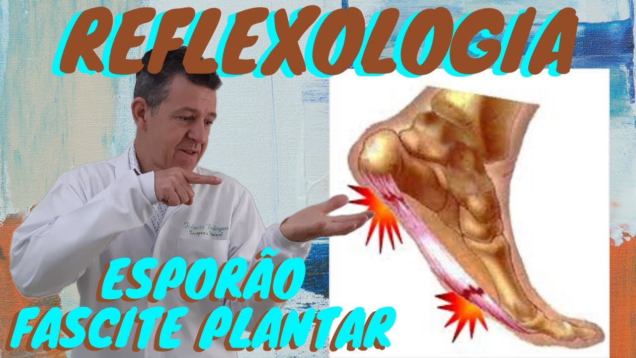 Dica R&aacute;pida ESPOR&Atilde;O de CALC&Acirc;NEO e FASCITE PLANTAR - REFLEXOLOGIA PODAL