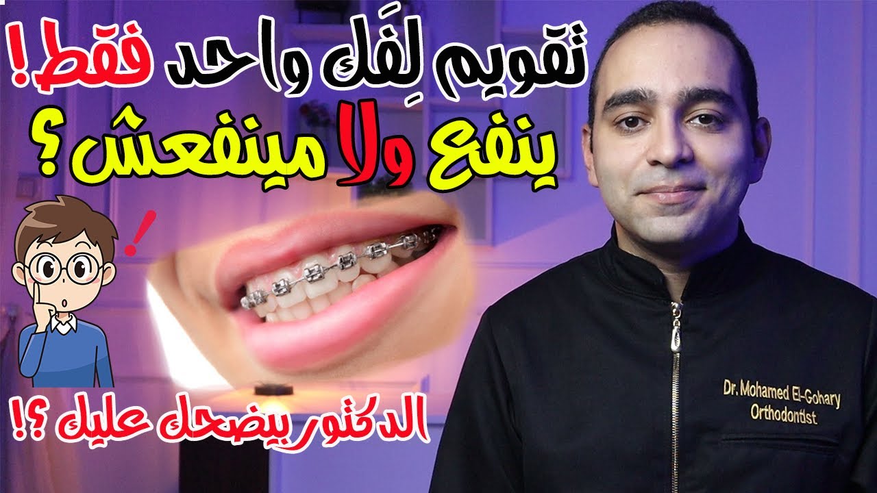 مشاكل تقويم الاسنان لفك واحد فقط ينفع ولا مينفعش؟🤔 الدكتور بيضحك عليك؟! 👨‍⚕️ هل فعلا غلط؟❗هل ممكن؟