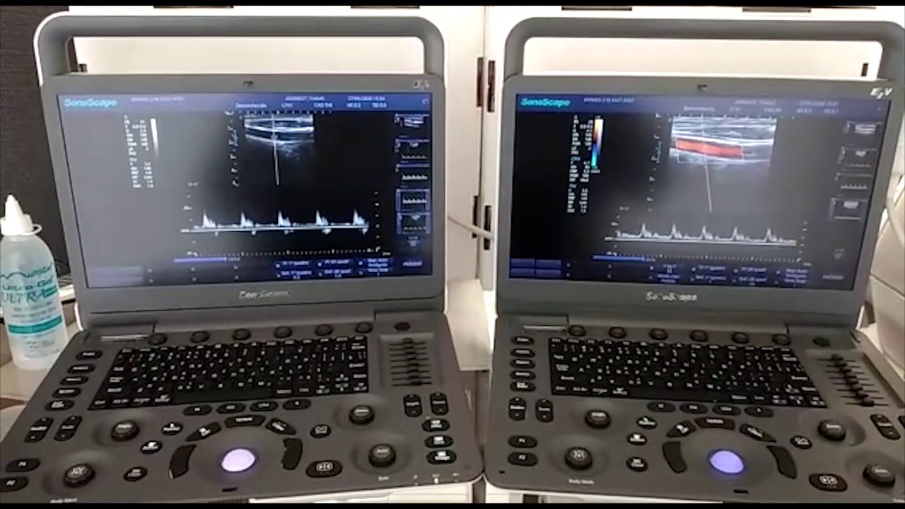 Diferença entre Doppler B/W e Color Doppler | Ultrassom Veterinário