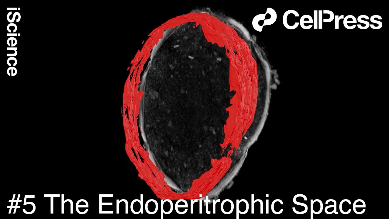 Micro CT Imaging of the Tobacco Hornworm Caterpillar : The Endoperitrophic Space