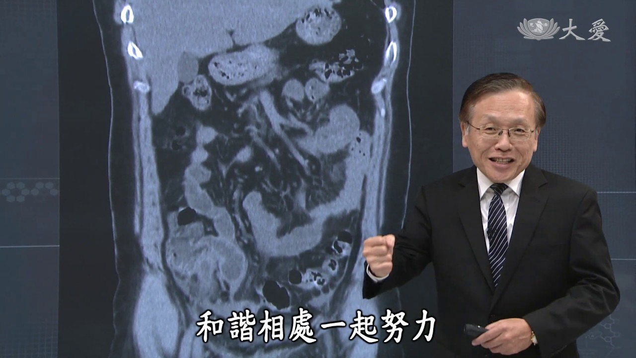 【大愛醫生館】20191212 - 盲腸炎變闌尾癌