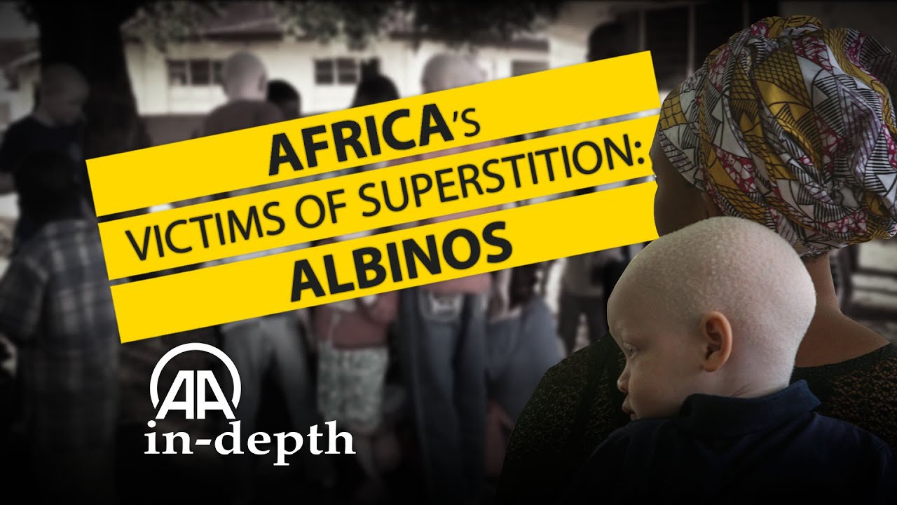Africa&rsquo;s Victims of Superstition: Albinos
