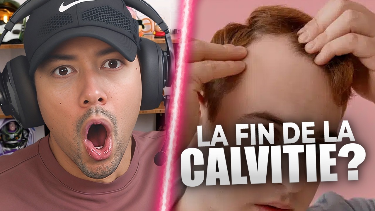 ENFIN LA FIN DE LA CALVITIE !? ► REACT