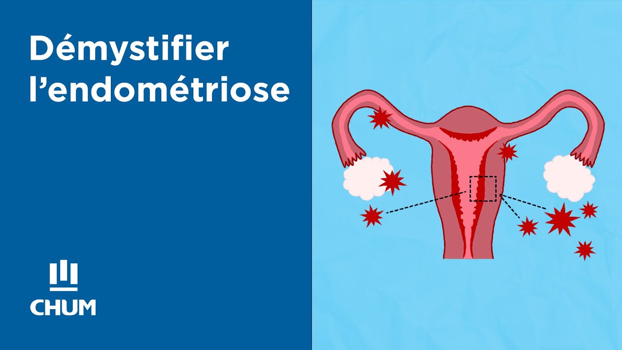 D&eacute;mystifier l'endom&eacute;triose