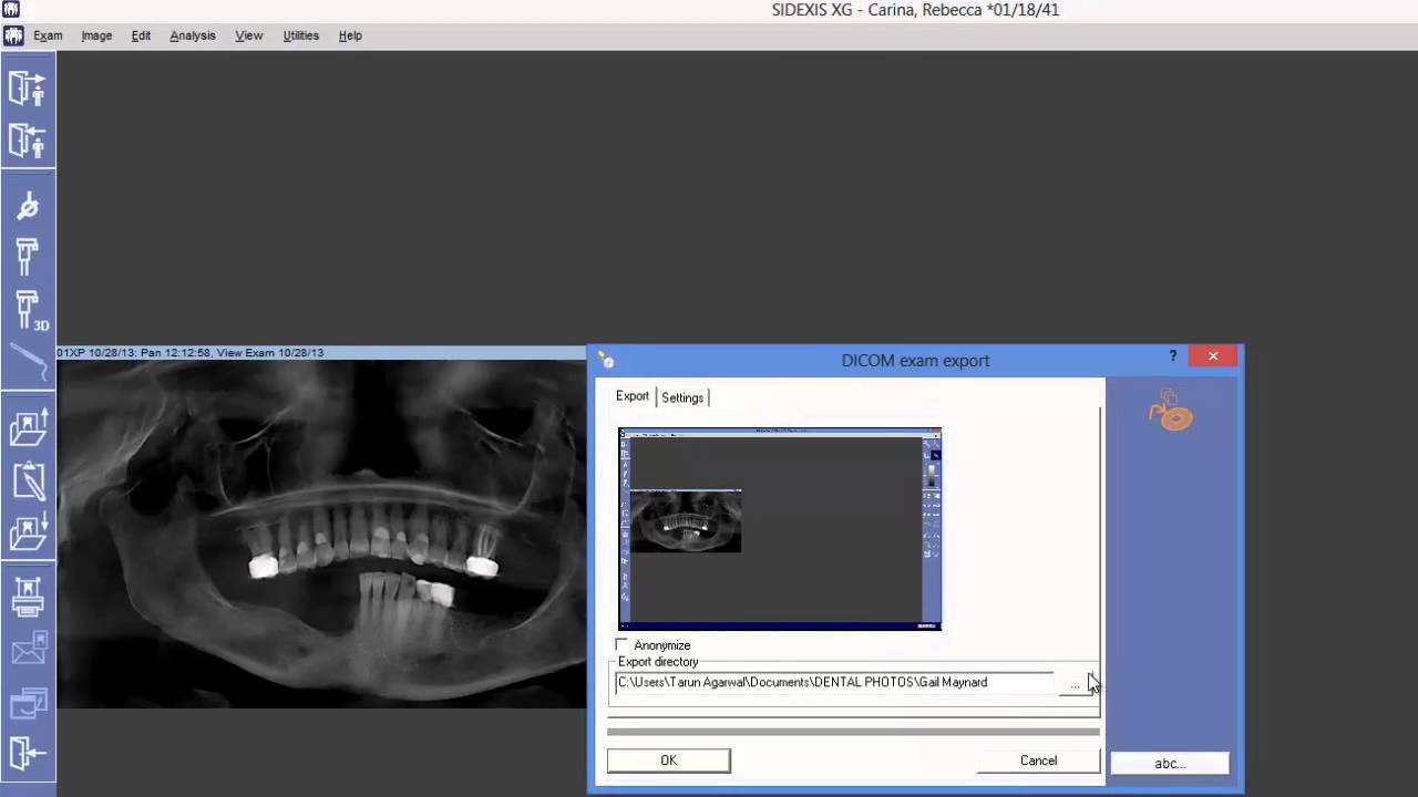 Sirona3D DICOM Export