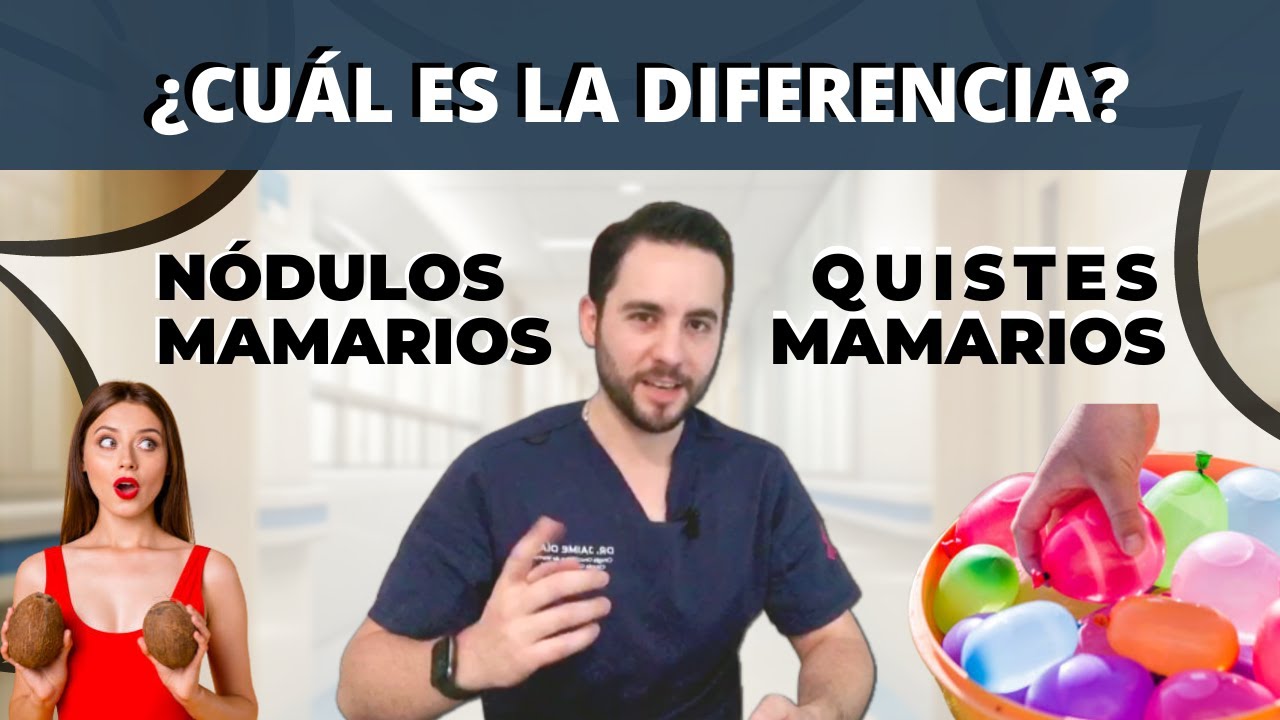 Principales diferencias entre N&oacute;dulos mamarios y Quistes mamarios