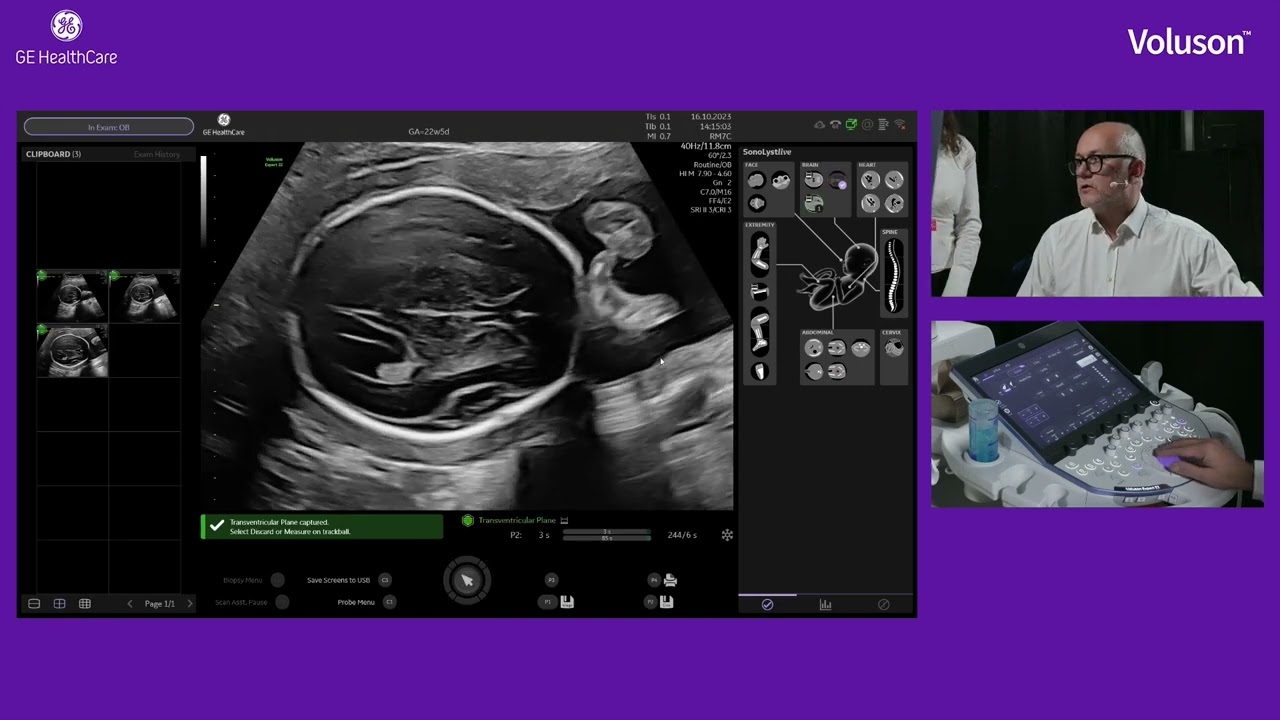 The Future is Now. How AI can Change the Practice of Obstetric Ultrasound.