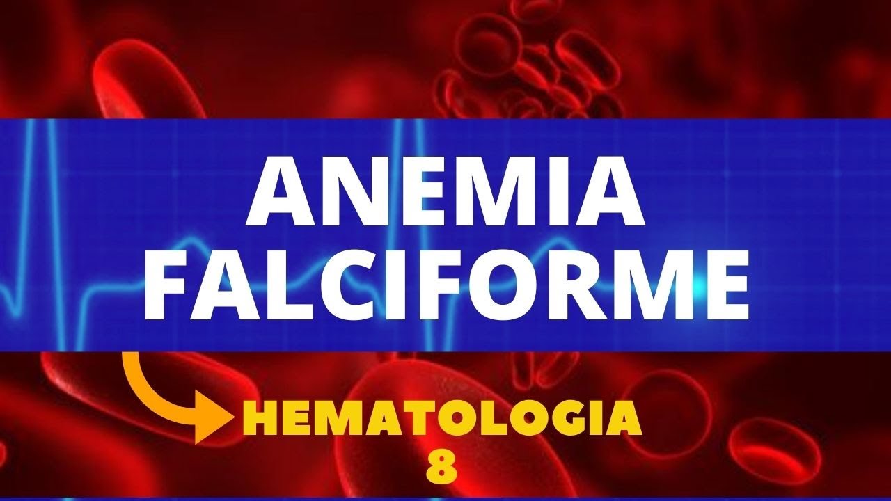 ANEMIA FALCIFORME - HEMATOLOGIA - AULA 8