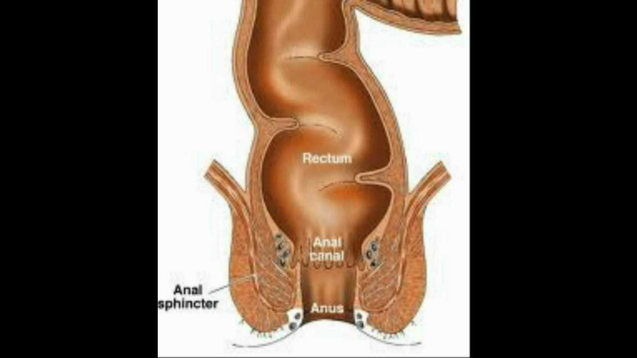 Rectal Cancer: An Overview | Los Angeles Colonoscopy