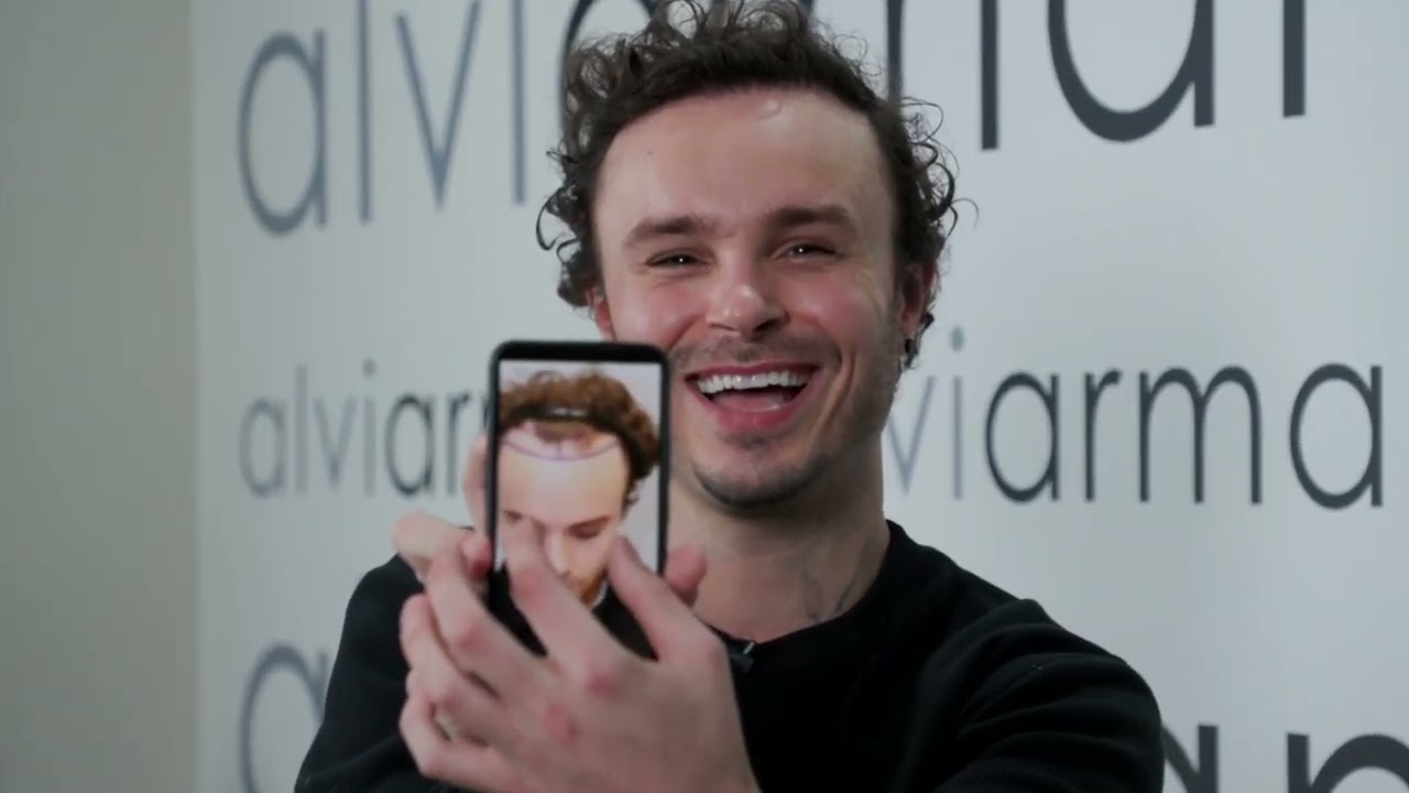 Johnny Apple Hair Transplant Results