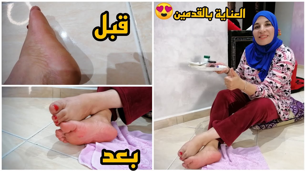 تهلاي في رجيلاتك في هاد الصيف 😍 توريد تبييض ترطيب لي شافك يسولك على سر رجيلاتك ❤️