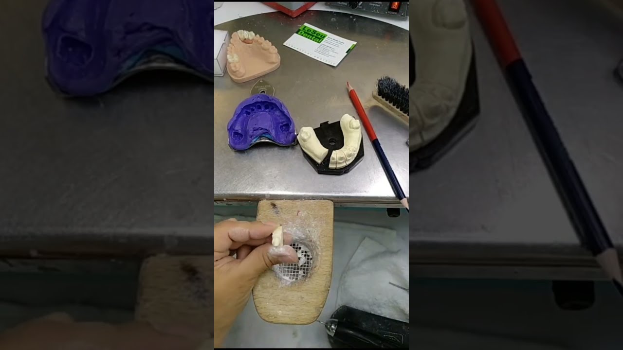 INDIVIDUALIZACIÓN DE MODELOS PARA PRÓTESIS FIJA #odontologia #boca #dentista #dental #zirconio