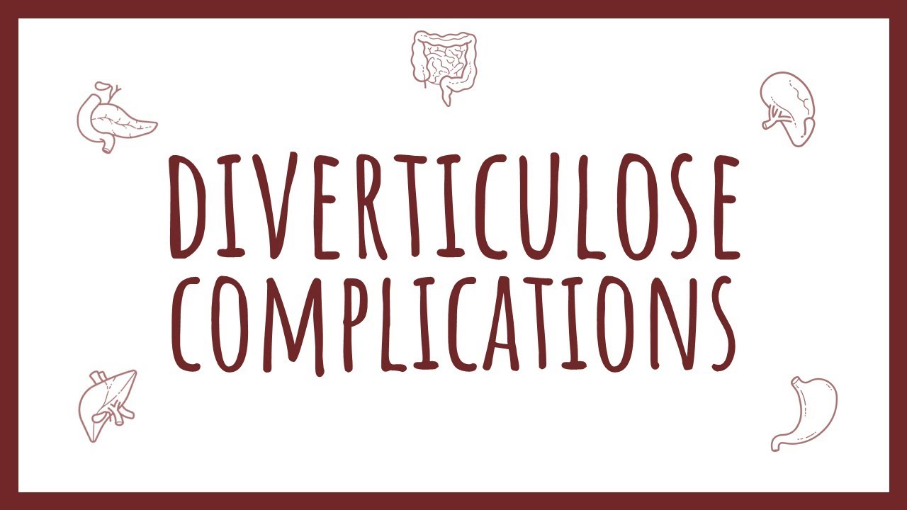 Sémiologie Chirurgicale - Complications de la Diverticulose Colique