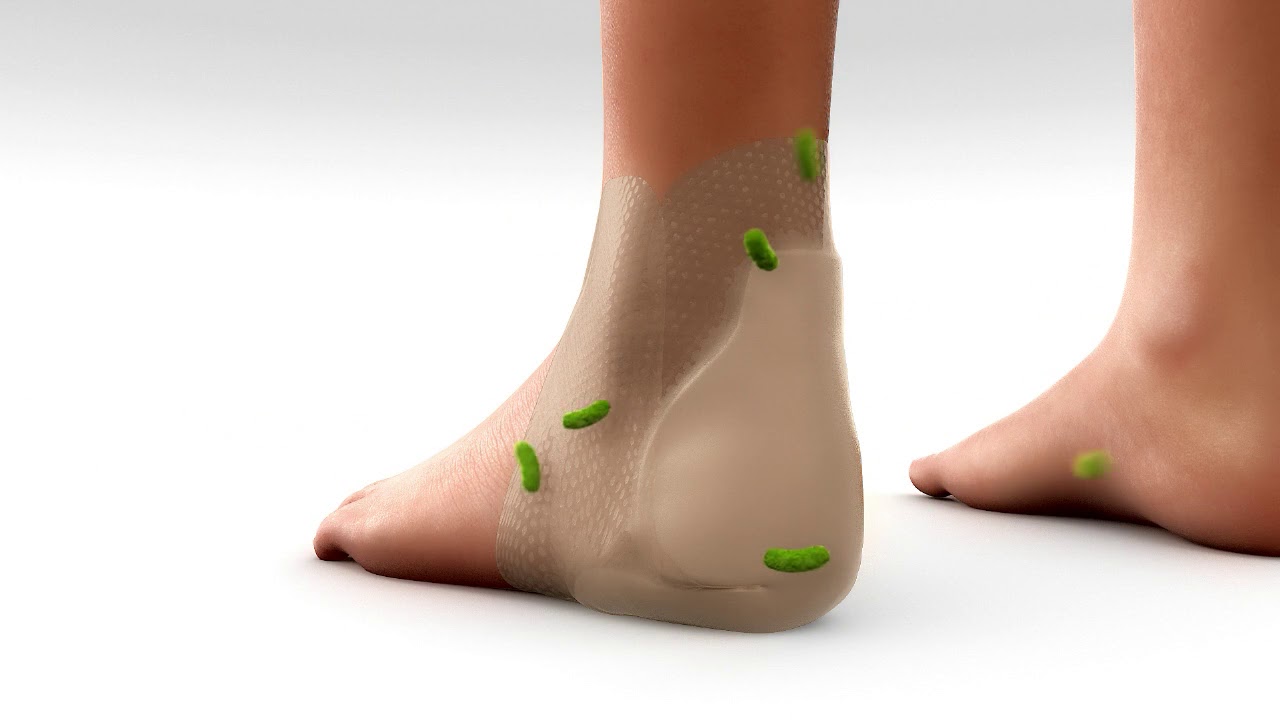 Mepilex® Border Heel  - Anwendungsvideo - Mölnlycke Health Care
