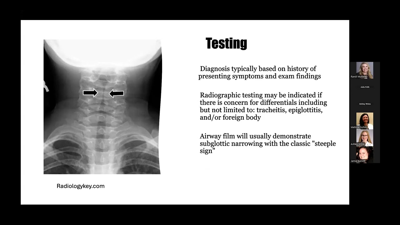 Infectious Diseases Grand Rounds: What's the Scoop on Croup
