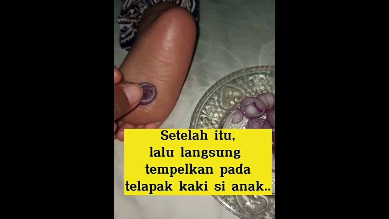 CARA MENGOBATI ANAK PANAS TINGGI SECARA ALAMI OBAT TRADISIONAL#shorts