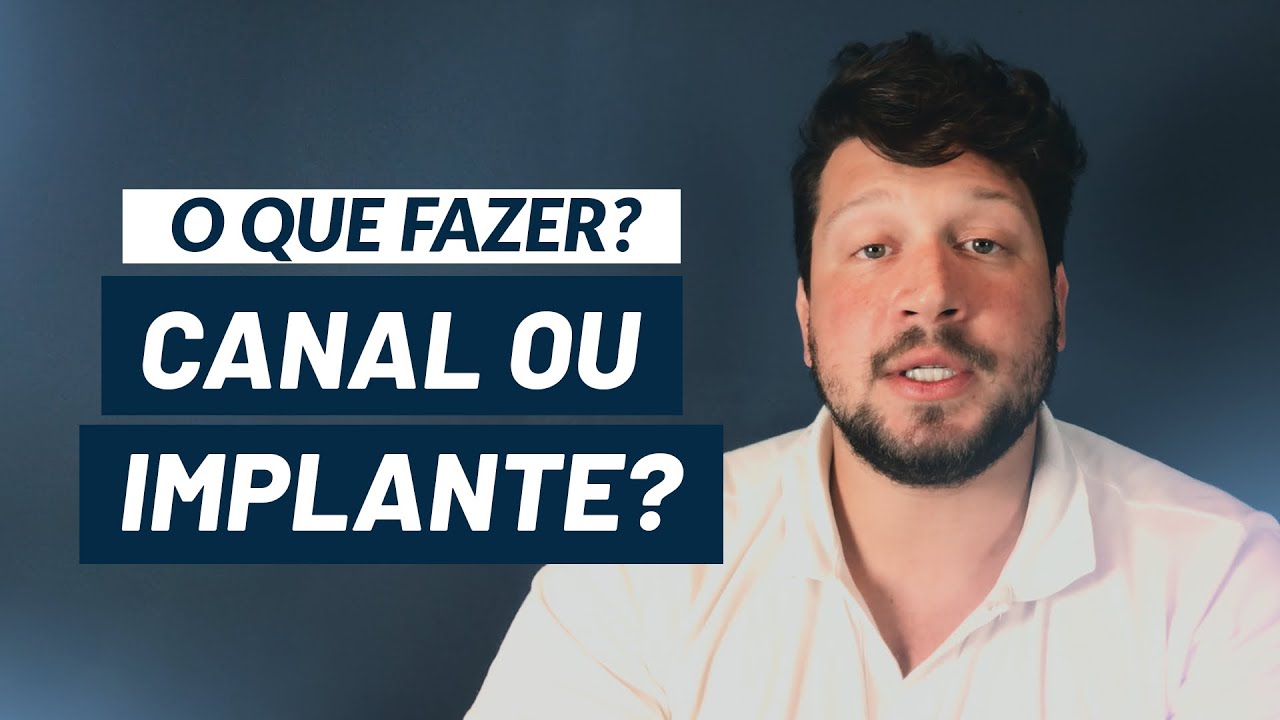 Vale a pena fazer canal ou implante?| Dr. Victor Hugo Almeida