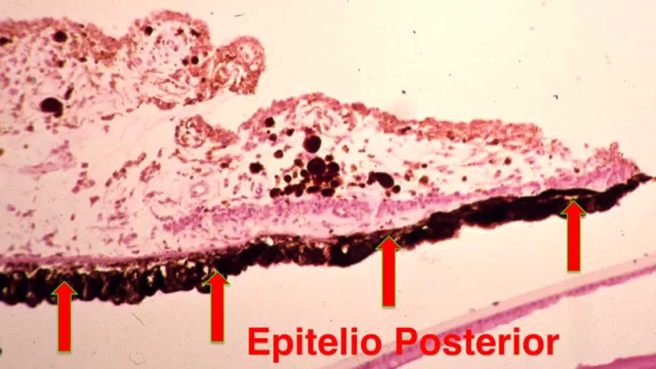 Histología del iris.  Centro de Oftalmología Bonafonte. Barcelona. España