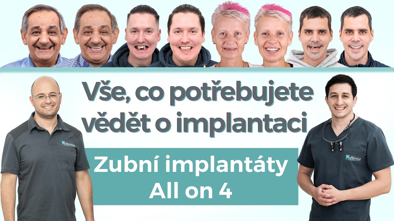 TOP dotazu o zubní implantaci All-on-X Jak probíhá implantace zubů?