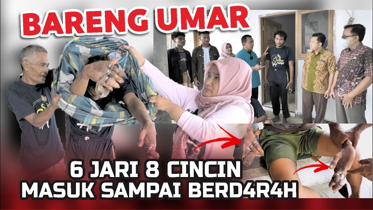 NGILUUU BANGET 😰❗BEBERAPA JARINYA HAMPIR PUT#S | BERSAMA UMAR