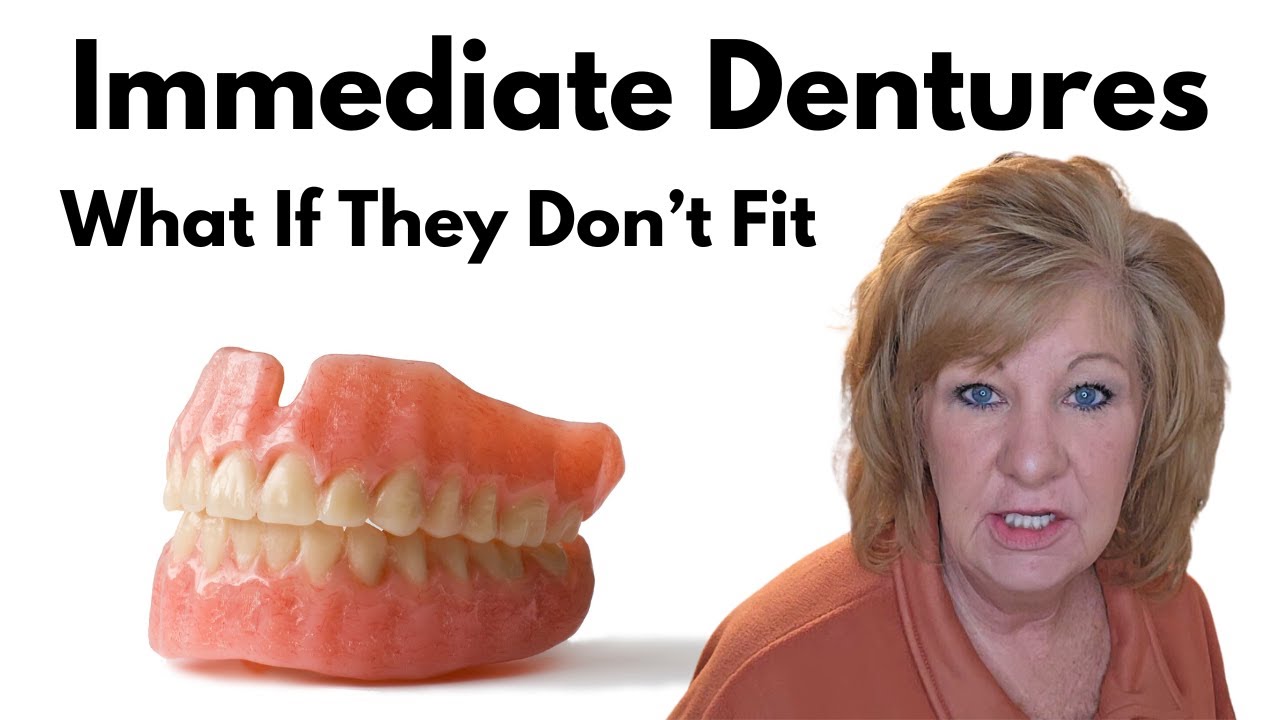 Immediate Dentures / How Are Immediate Dentures Made