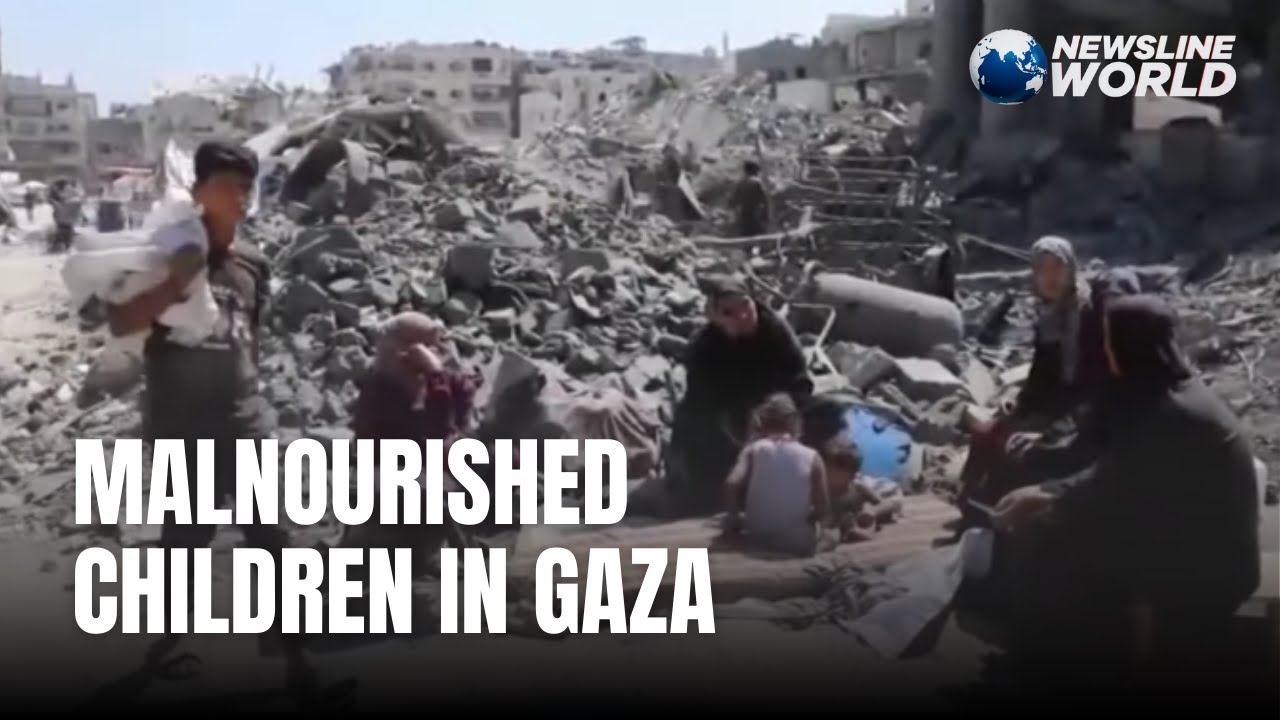 Gaza hospital struggles to save children from acute malnutrition amid food, medicine shortages