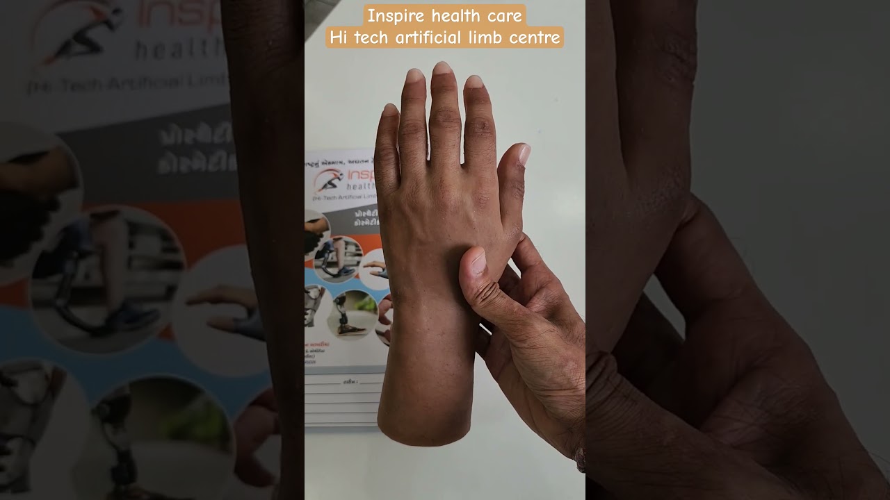 🔸Best quality Silicone Artificial hand 🖐️ at Inspire health care, Hi tech artificial limb centre