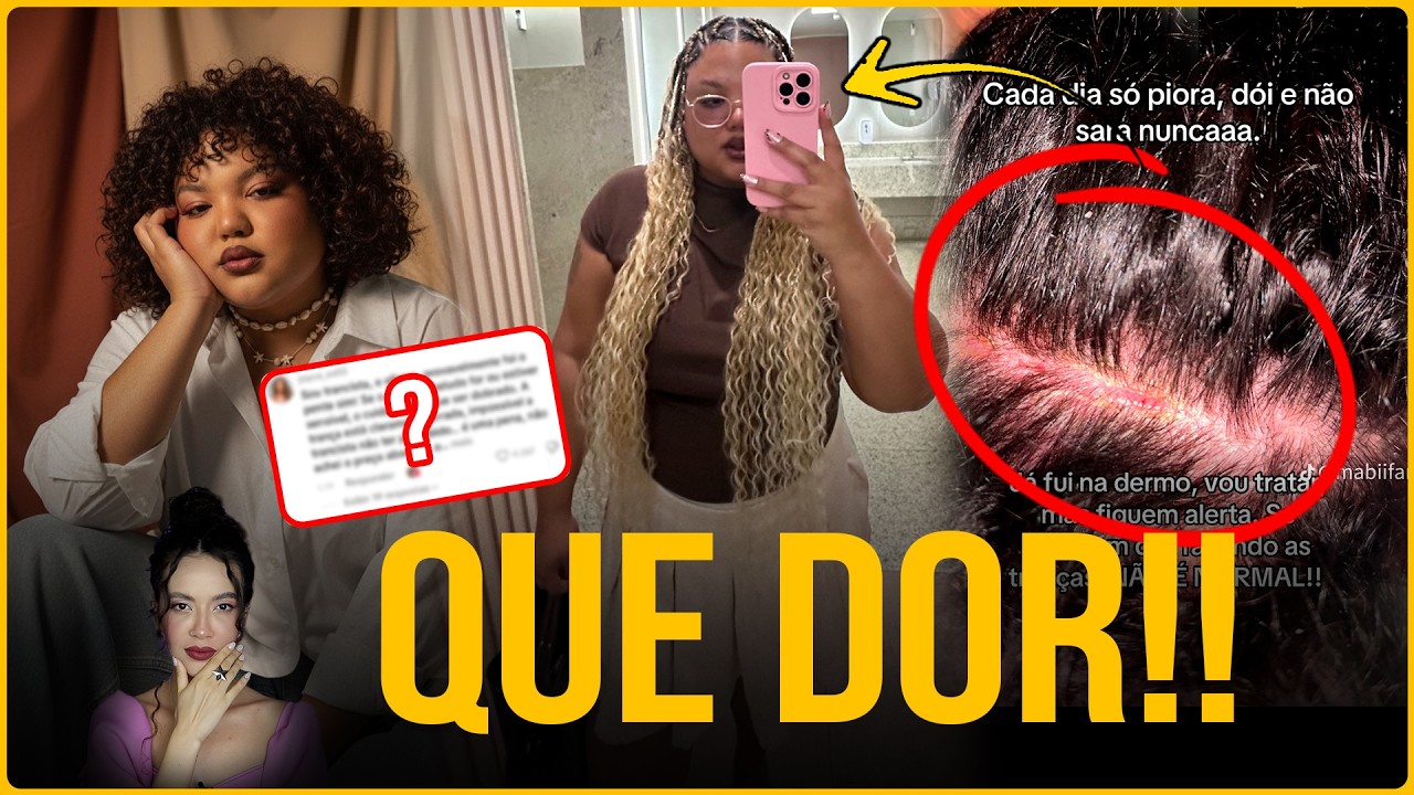 MENINA FICOU COM FERIDA PROFUNDA PÓS TRANÇAS!