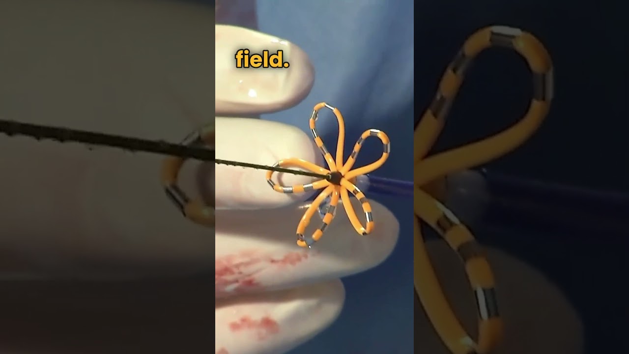 FARAPULSE PFA System and the FARAWAVE PFA Catheter