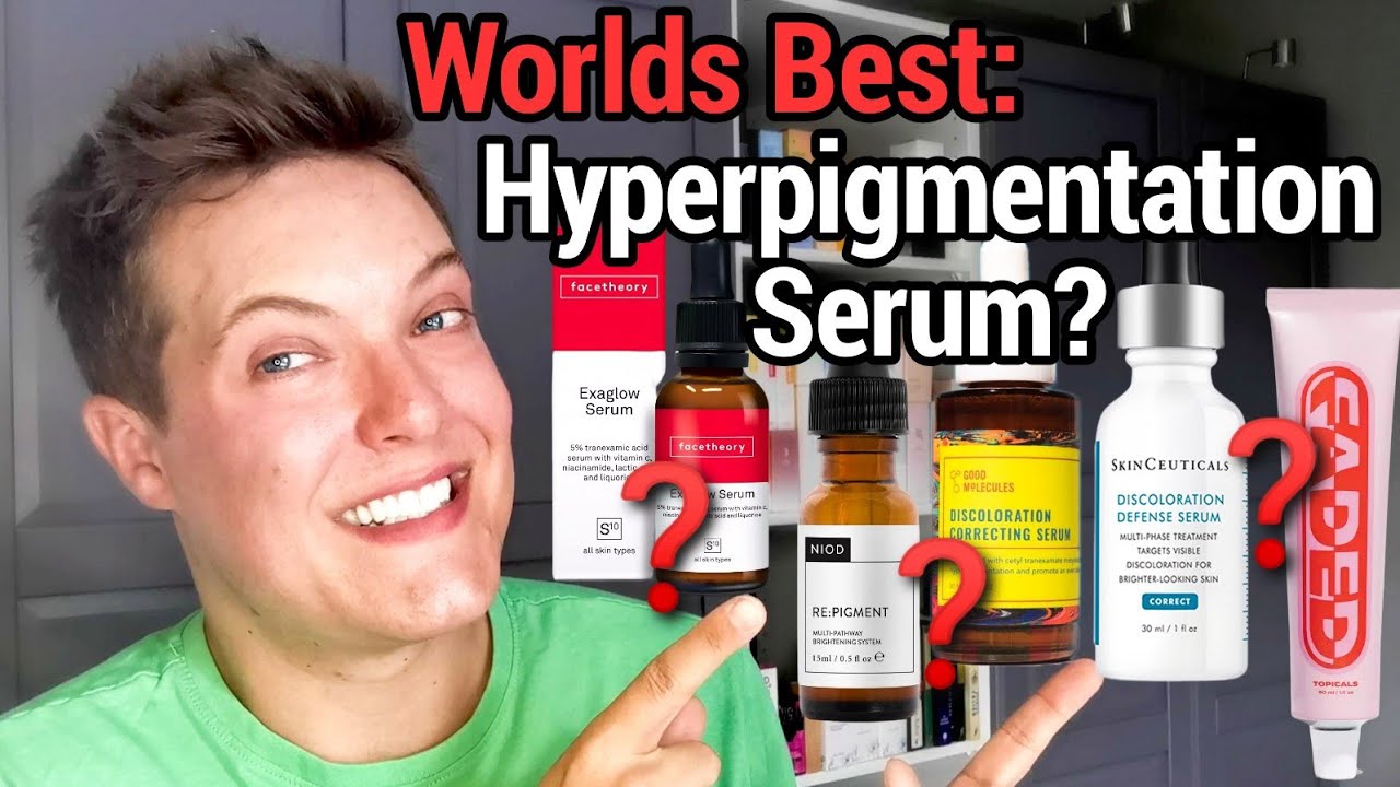 OFFICIAL - Worlds Best HYPERPIGMENTATION SERUM (Brighter Skin Guaranteed)