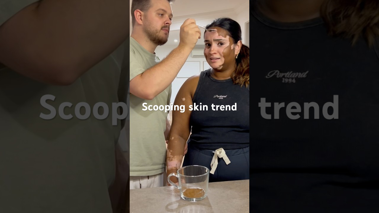 Sub to @onellaandryan #coffee #latte #skin #vitiligo #trend #couple #coffee lover #funny #funnyvideo