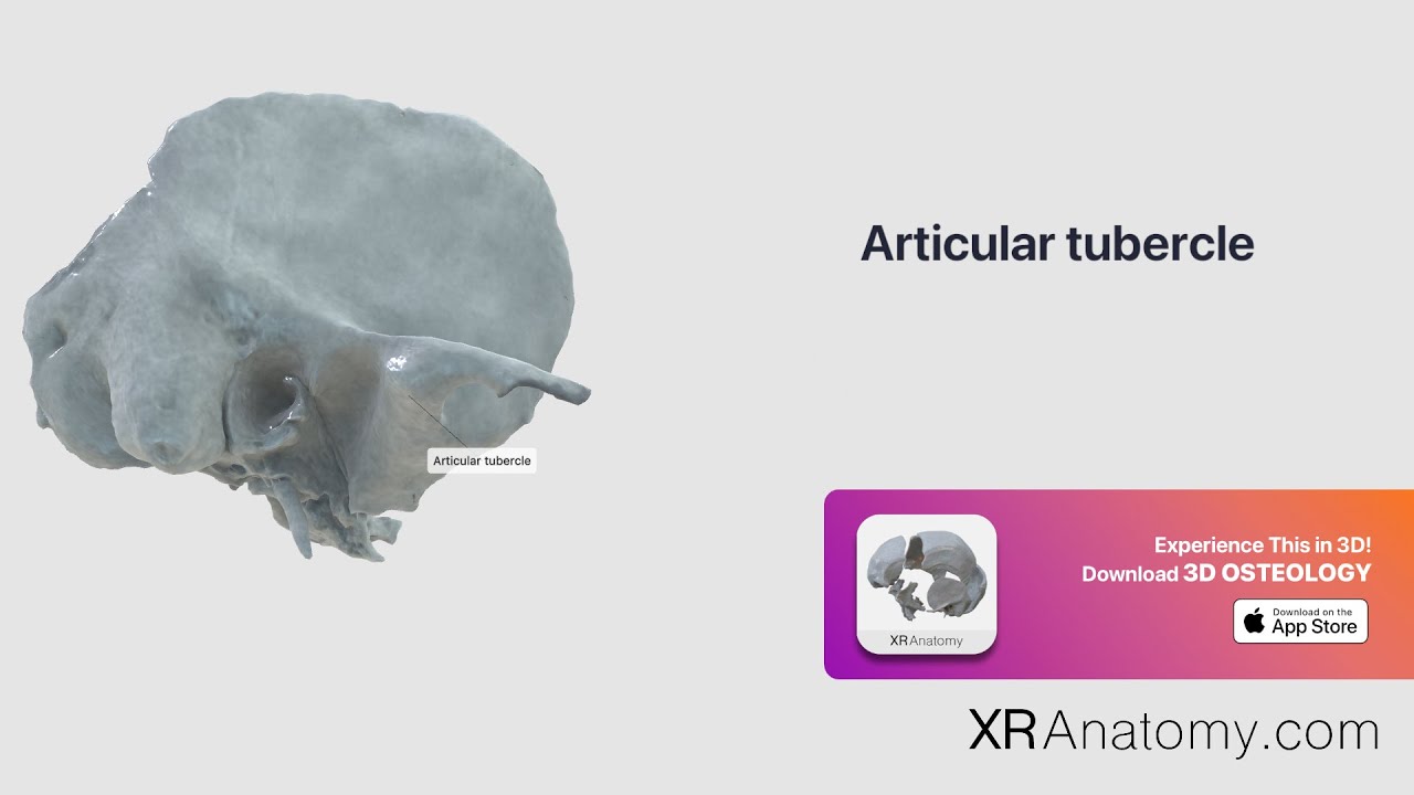 Temporal Bone - Articular tubercle