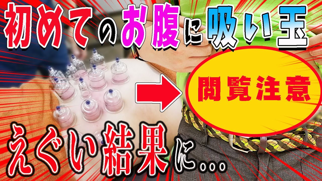 【吸い玉】閲覧注意！お腹の吸い玉を初めてしたら、えぐい結果に…