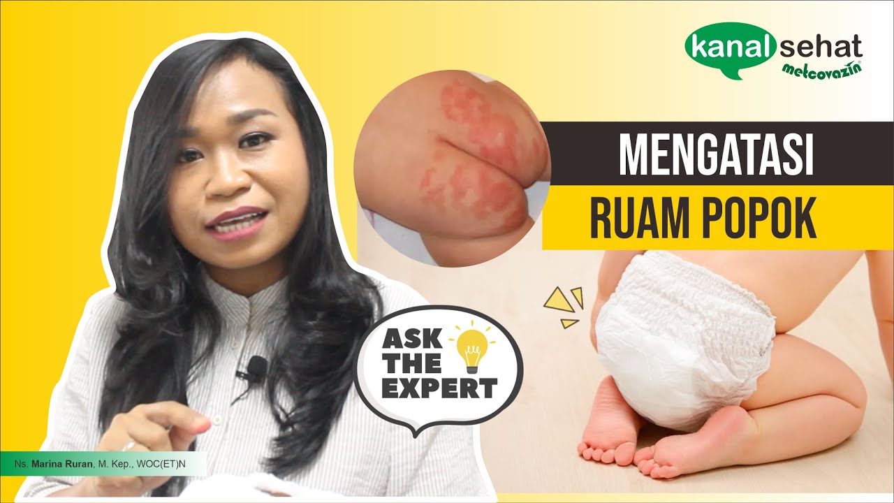 Cara Mengatasi Ruam Popok Pada Bayi - Ask The Expert