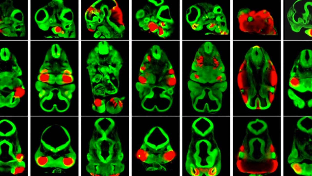 Fine Tuning of Facial Morphology with Enhancers