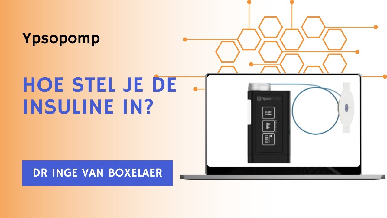 Mylife Loop Academy | Hoe stel je insuline in op de Ypsopump insulinepomp?