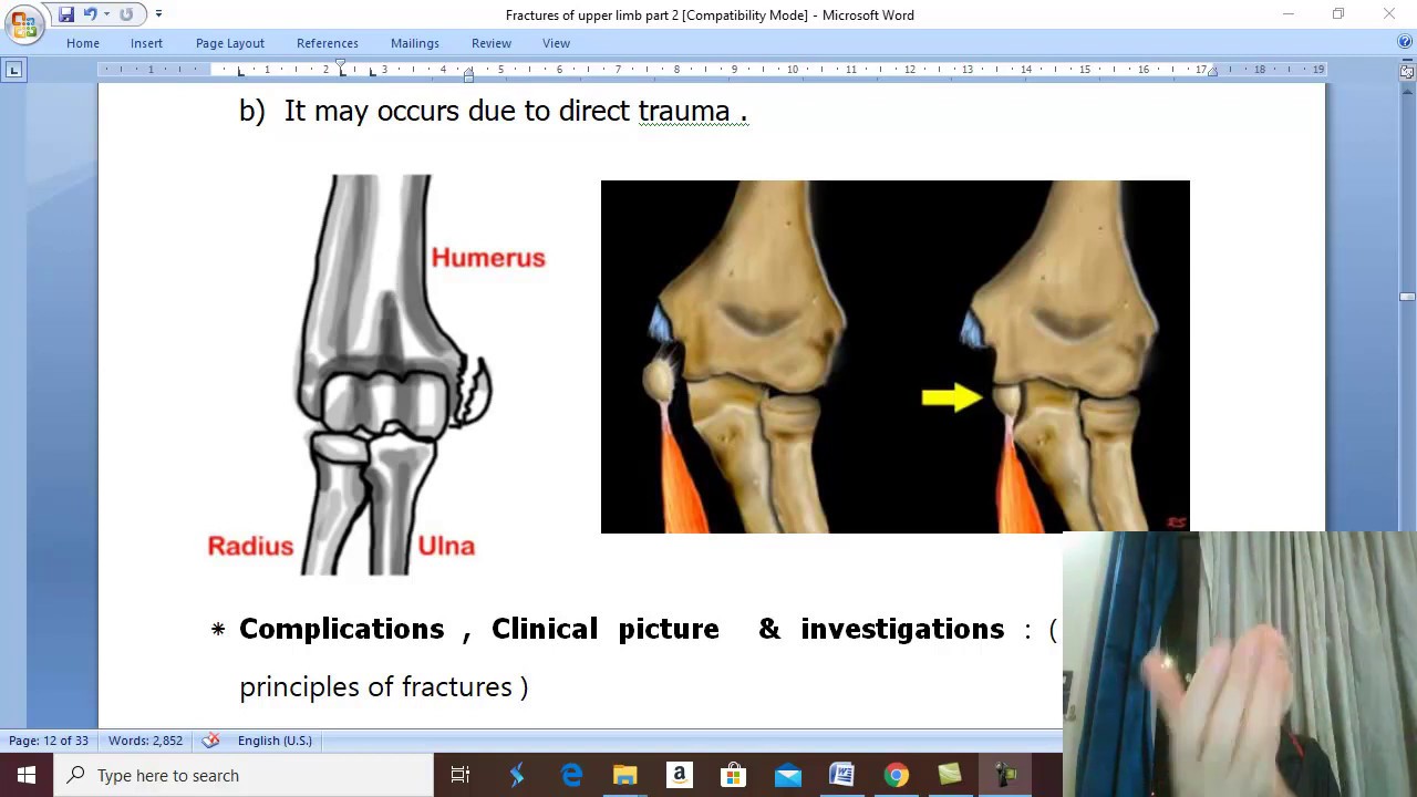 Orthopedic in Arabic 18( Fracture of epicondyles of the humerus ) , by Dr.Wahdan