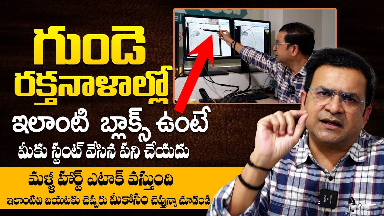 ఇలాంటి బ్లాక్స్ ఉన్నపుడు ఎలా క్లీన్ చేయాలంటే - Dr Movva Srinivas | Calcium Blockage in Heart | THF