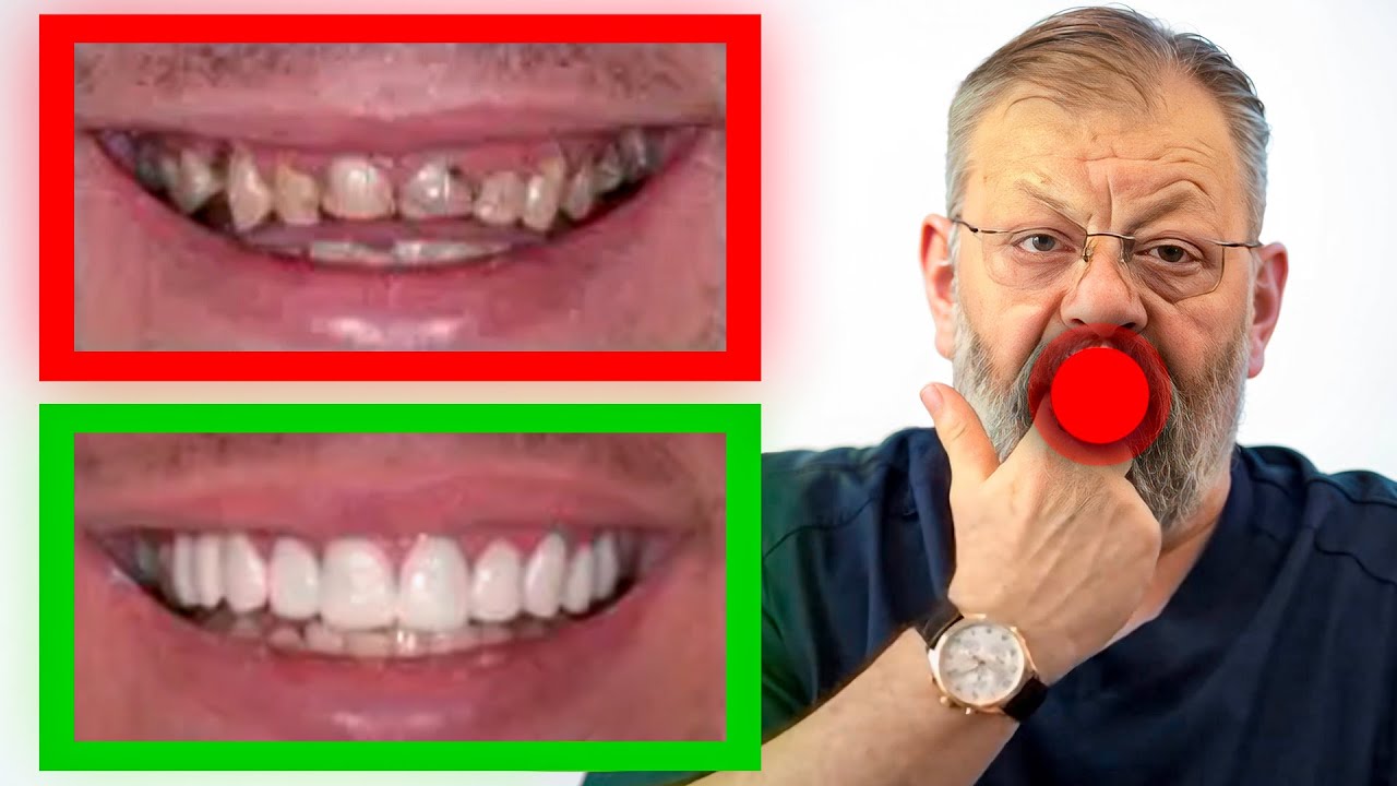 Здоровые зубы. 3 упражнения за 3 минуты в день!