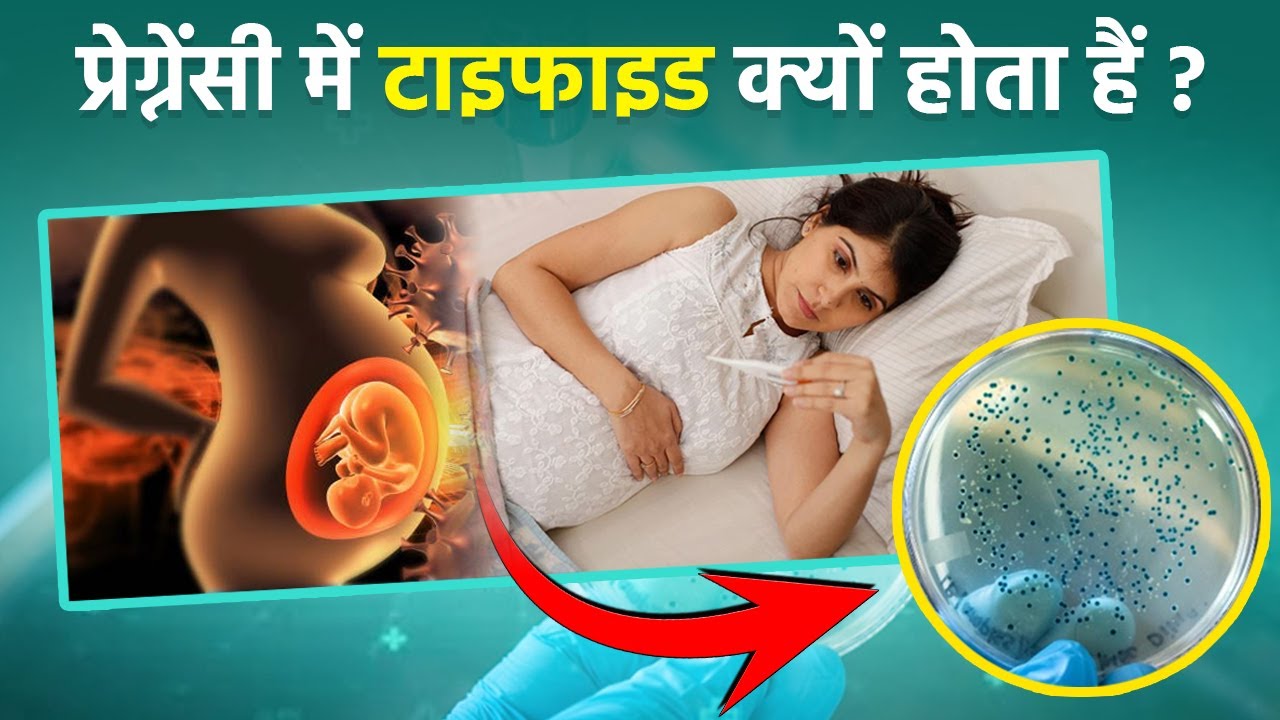 Typhoid Reason During pregnancy: प्रेगनेंसी में टाइफाइड क्यों होती है। कारण और बचाव | Boldsky