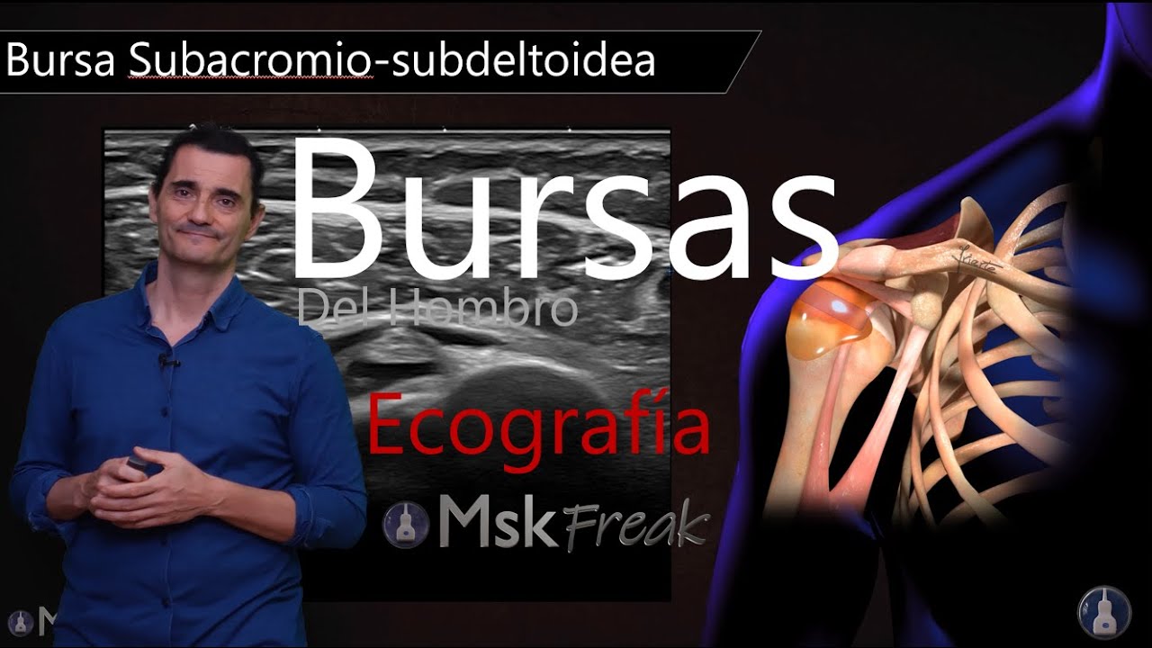 BURSAS DEL HOMBRO CON ECOGRAFÍA (PARTE II) | Identificación Anatómica en Tiempo Real