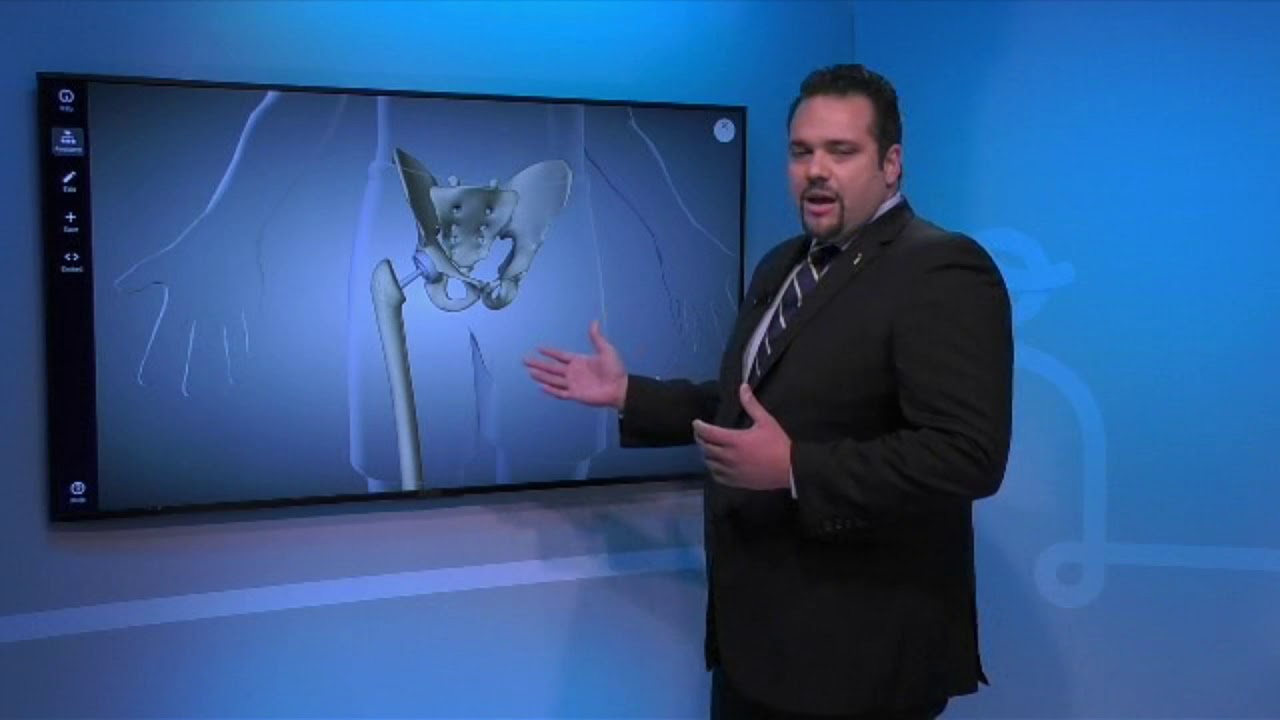 Hip Replacement, The Solution for Femoral Neck Fracture