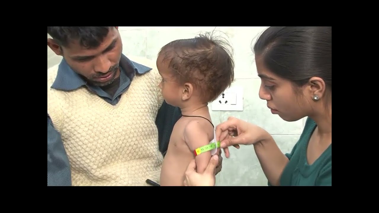 How to Measure MUAC in Child for SAM/MAM Screening | Step-by-Step Guide