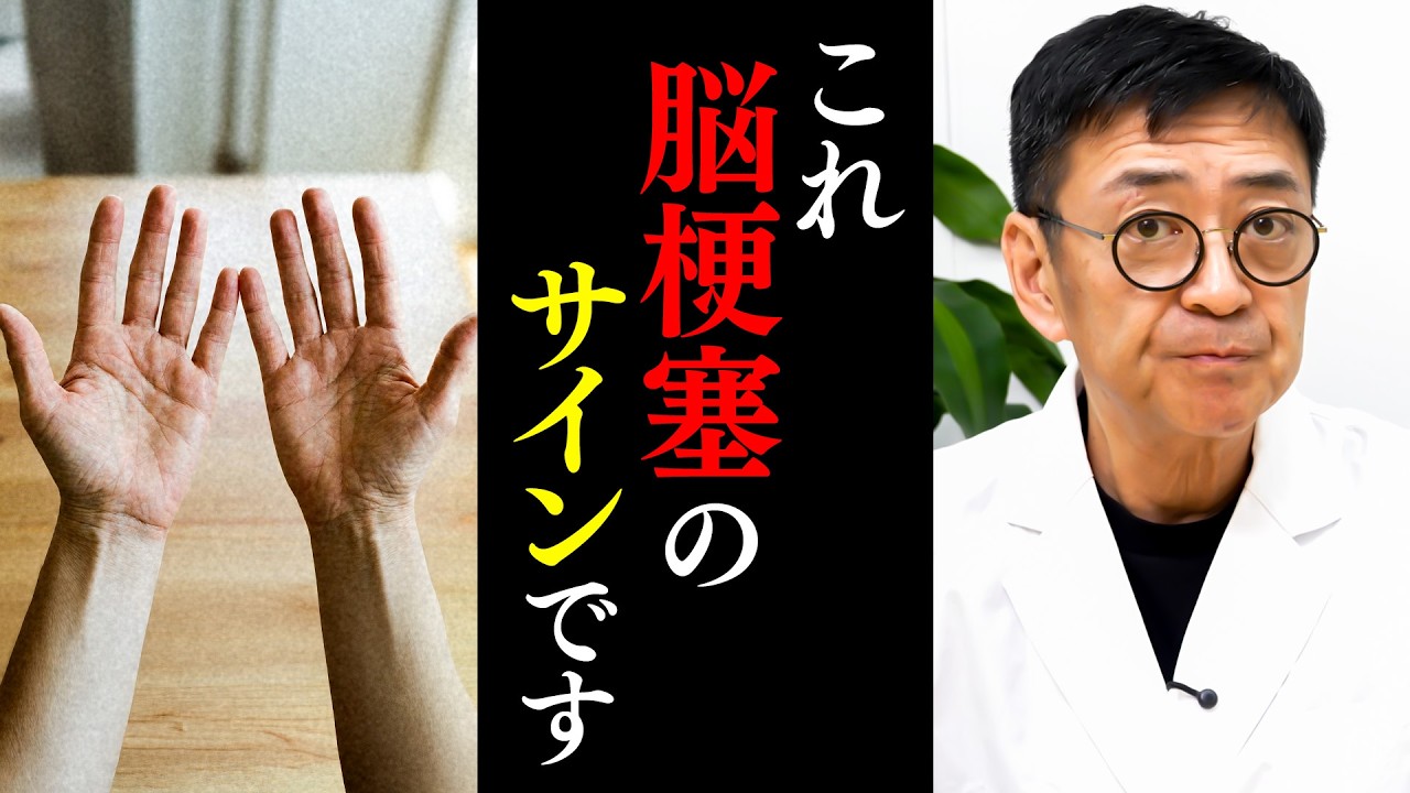 【医師解説】放置厳禁！脳梗塞が起こる前に現れる「手の危険サイン」と「ミニ脳梗塞」の正体