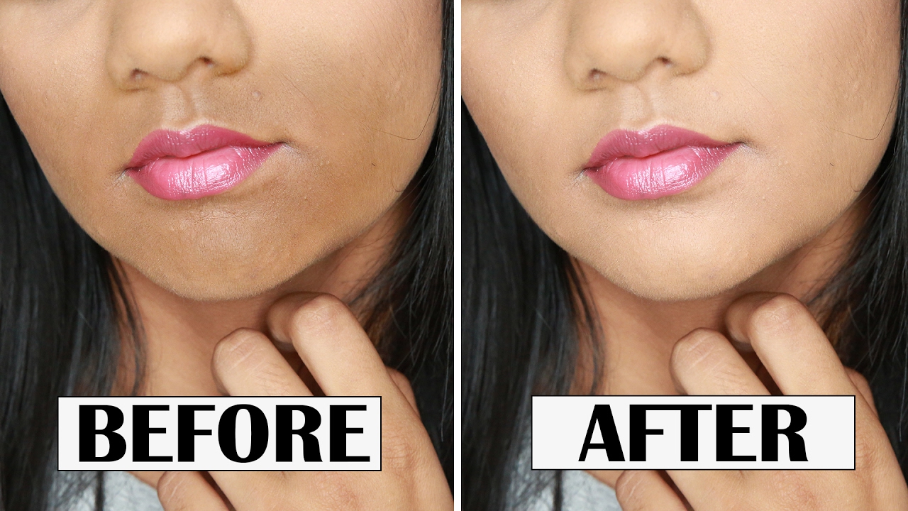 HOW TO CONCEAL DARKNESS AROUND YOUR MOUTH | ZAHRAH ALIYAH