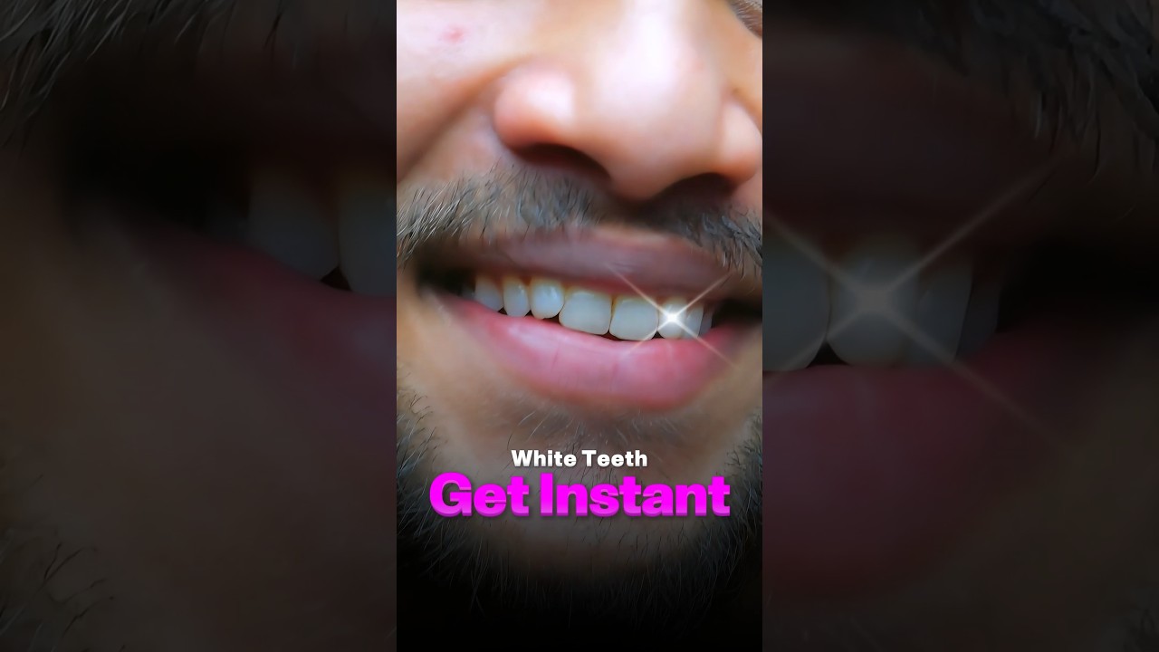 ✅ Secret Trick for Instant White Teeth 🦷✨#shorts #youtubeshorts #skincare