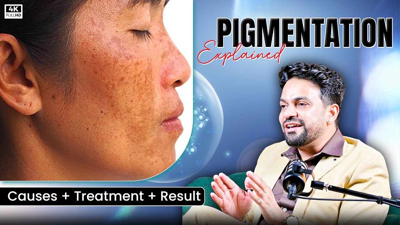 Pigmentation Explained—Melasma, Sunspots & Post-Inflammatory Spots  #pigmentation
