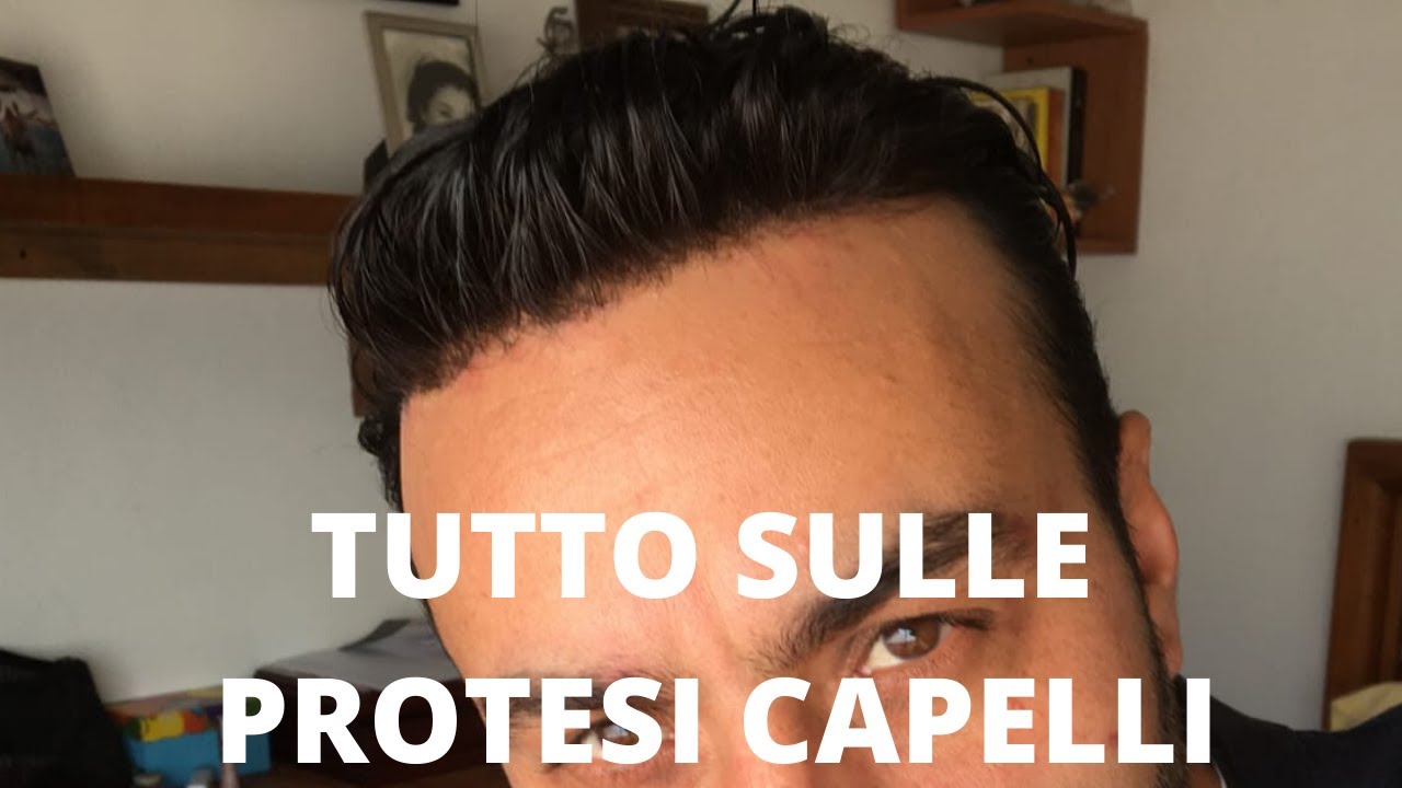 Protesi capelli  RISPONDE  l' esperto di Newlacecu (tutorial Italiano) 20 risposte utili