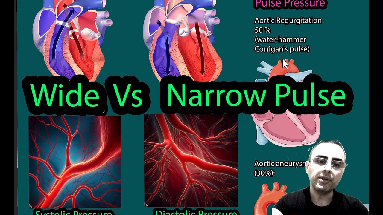 Narrow pulse pressure vs Wide Pulse pressure